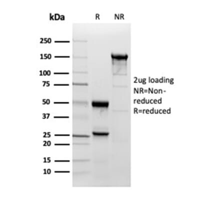 SDS-PAGE - Anti-Superoxide Dismutase 1 Antibody [SOD1/3923] - BSA and Azide free (A278383) - Antibodies.com