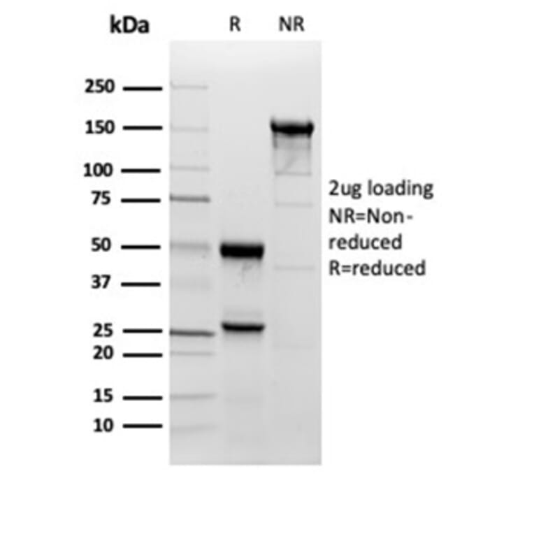 SDS-PAGE - Anti-Superoxide Dismutase 1 Antibody [SOD1/3923] - BSA and Azide free (A278383) - Antibodies.com