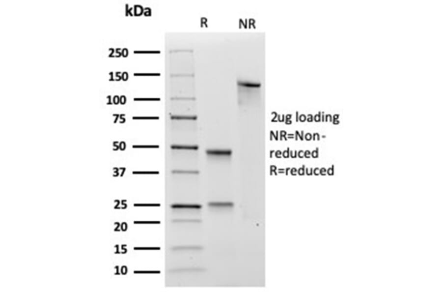 SDS-PAGE - Anti-SOX4 Antibody [PCRP-SOX4-1D6] - BSA and Azide free (A278384) - Antibodies.com
