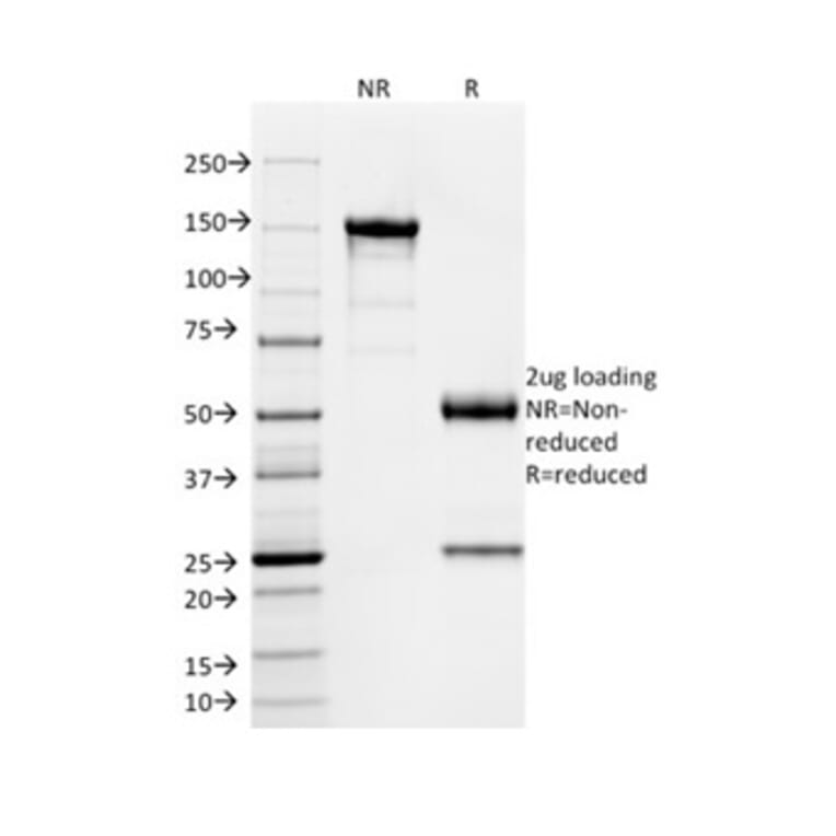 SDS-PAGE - Anti-SOX9 Antibody [PCRP-SOX9-1A2] - BSA and Azide free (A278386) - Antibodies.com