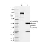 SDS-PAGE - Anti-SOX9 Antibody [PCRP-SOX9-1A2] - BSA and Azide free (A278386) - Antibodies.com