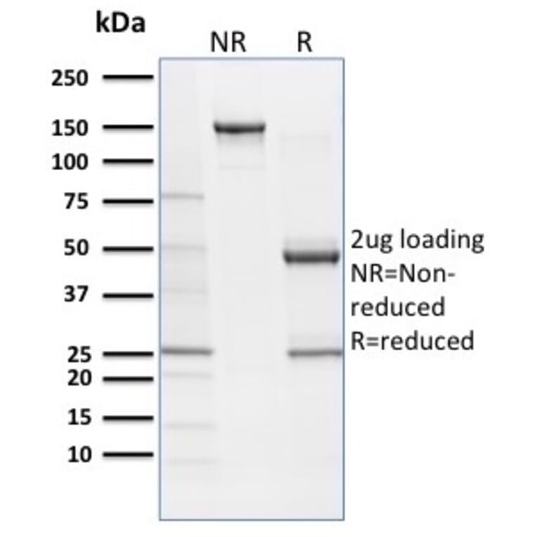 SDS-PAGE - Anti-SOX9 Antibody [SOX9/2387] - BSA and Azide free (A278388) - Antibodies.com