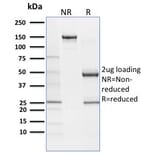 SDS-PAGE - Anti-SOX9 Antibody [SOX9/2387] - BSA and Azide free (A278388) - Antibodies.com