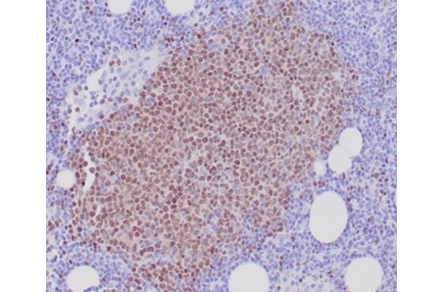 Immunohistochemistry - Anti-SOX11 Antibody [SOX11/7236] - BSA and Azide free (A278389) - Antibodies.com