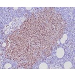 Immunohistochemistry - Anti-SOX11 Antibody [SOX11/7236] - BSA and Azide free (A278389) - Antibodies.com