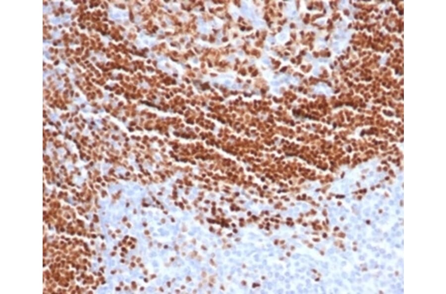 Immunohistochemistry - Anti-SOX11 Antibody [SOX11/7236] - BSA and Azide free (A278389) - Antibodies.com