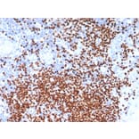 Immunohistochemistry - Anti-SOX11 Antibody [SOX11/7236] - BSA and Azide free (A278389) - Antibodies.com