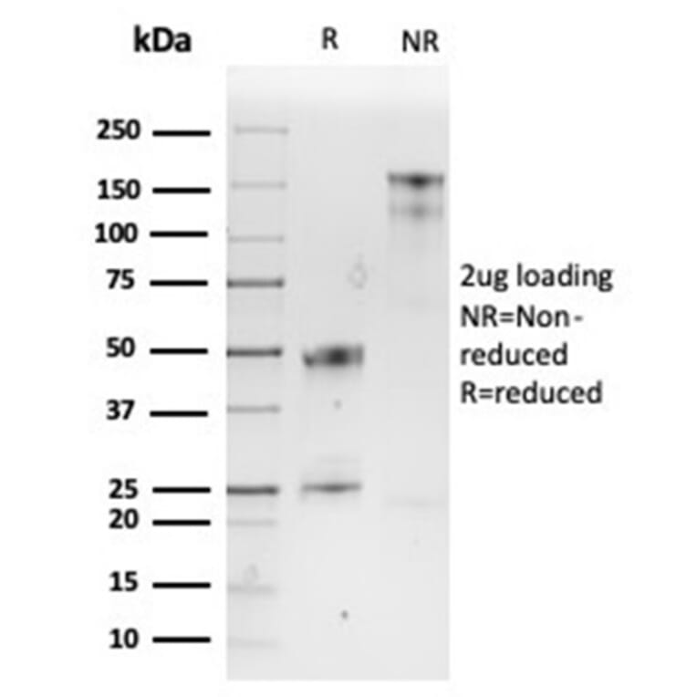 SDS-PAGE - Anti-SPARC Antibody [OSTN/3932] - BSA and Azide free (A278391) - Antibodies.com