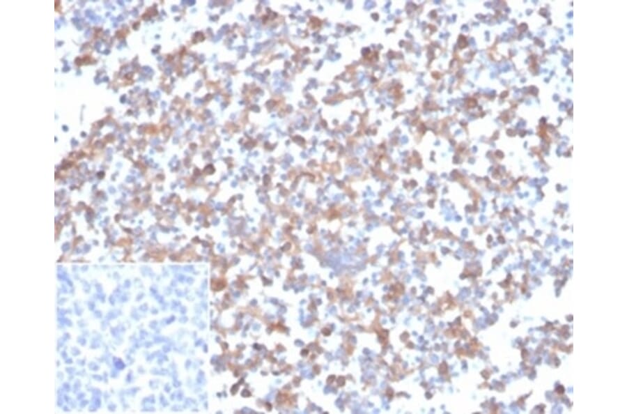 Immunohistochemistry - Anti-SPARC Antibody [OSTN/3933] - BSA and Azide free (A278392) - Antibodies.com