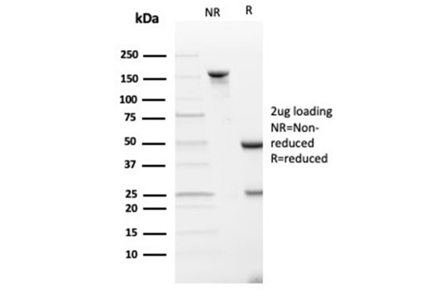 SDS-PAGE - Anti-SPARC Antibody [OSTN/3933] - BSA and Azide free (A278392) - Antibodies.com