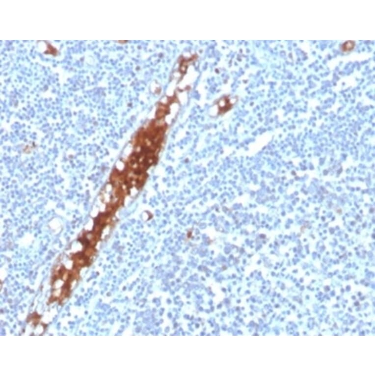 Immunohistochemistry - Anti-SPARC Antibody [OSTN/3304] - BSA and Azide free (A278393) - Antibodies.com