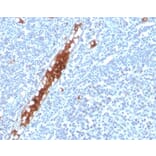 Immunohistochemistry - Anti-SPARC Antibody [OSTN/3304] - BSA and Azide free (A278393) - Antibodies.com