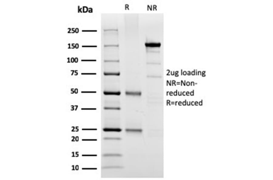 SDS-PAGE - Anti-SPARC Antibody [OSTN/3304] - BSA and Azide free (A278393) - Antibodies.com