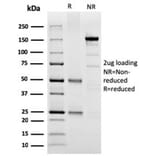 SDS-PAGE - Anti-SPARC Antibody [OSTN/3304] - BSA and Azide free (A278393) - Antibodies.com