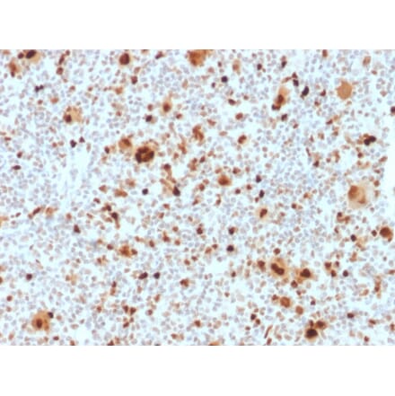 Immunohistochemistry - Anti-PU.1 Antibody [PU1/2118] - BSA and Azide free (A278397) - Antibodies.com