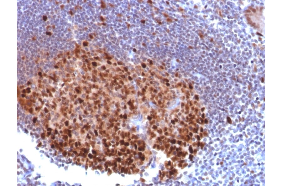 Immunohistochemistry - Anti-PU.1 Antibody [PU1/2118] - BSA and Azide free (A278397) - Antibodies.com