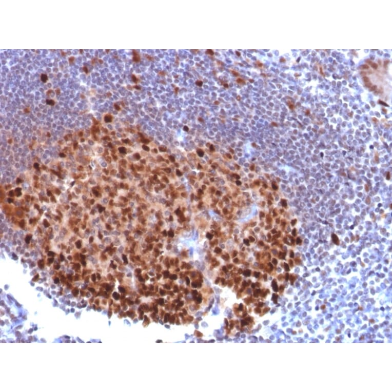 Immunohistochemistry - Anti-PU.1 Antibody [PU1/2118] - BSA and Azide free (A278397) - Antibodies.com