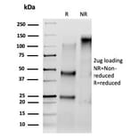 SDS-PAGE - Anti-Serum Response Factor Antibody [PCRP-SRF-1F7] - BSA and Azide free (A278403) - Antibodies.com