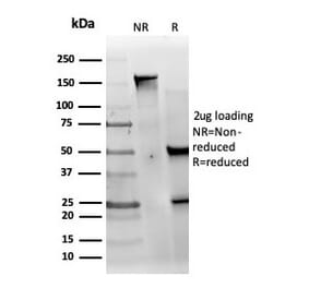 SDS-PAGE - Anti-MED22 Antibody [PCRP-MED22-1E4] - BSA and Azide free (A278404) - Antibodies.com