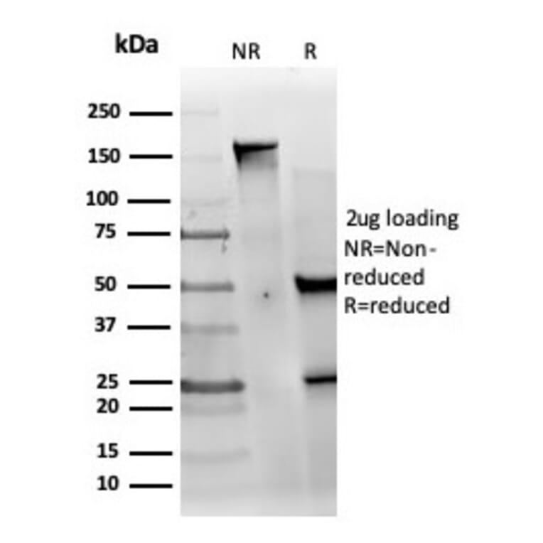 SDS-PAGE - Anti-MED22 Antibody [PCRP-MED22-1E4] - BSA and Azide free (A278404) - Antibodies.com