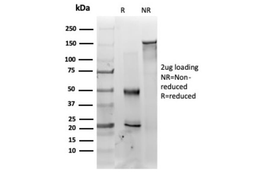SDS-PAGE - Anti-MED22 Antibody [PCRP-MED22-2A7] - BSA and Azide free (A278405) - Antibodies.com