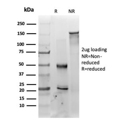 SDS-PAGE - Anti-MED22 Antibody [PCRP-MED22-2A7] - BSA and Azide free (A278405) - Antibodies.com