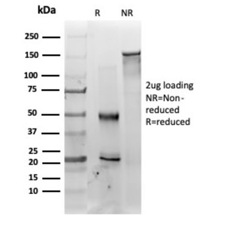 SDS-PAGE - Anti-MED22 Antibody [PCRP-MED22-2A7] - BSA and Azide free (A278405) - Antibodies.com