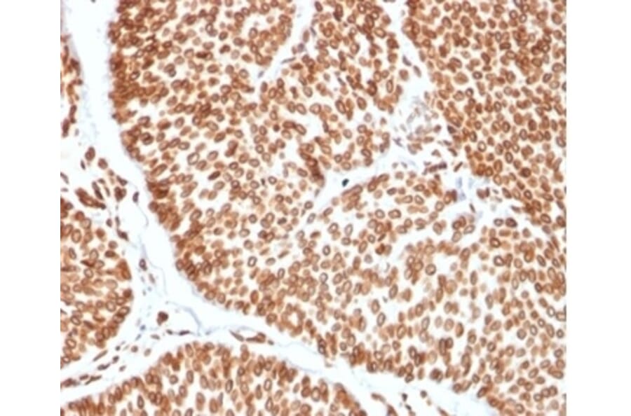 Immunohistochemistry - Anti-TCF4 Antibody [TCF4/2252] - BSA and Azide free (A278406) - Antibodies.com