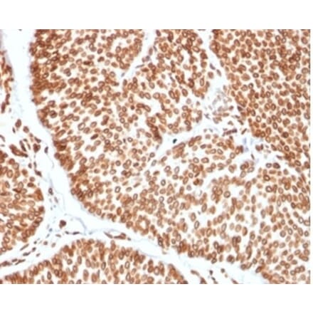 Immunohistochemistry - Anti-TCF4 Antibody [TCF4/2252] - BSA and Azide free (A278406) - Antibodies.com