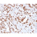 Immunohistochemistry - Anti-TCF4 Antibody [TCF4/2252] - BSA and Azide free (A278406) - Antibodies.com