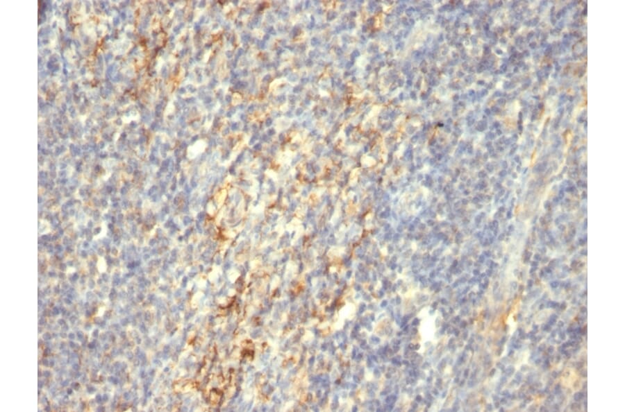 Immunohistochemistry - Anti-Transglutaminase II Antibody [SPM592] - BSA and Azide free (A278407) - Antibodies.com