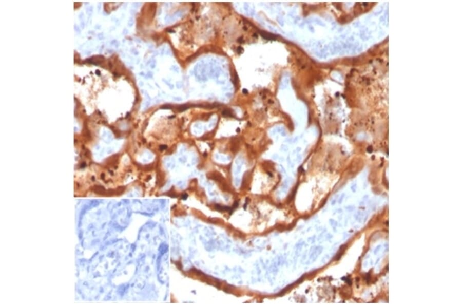 Immunohistochemistry - Anti-Transglutaminase II Antibody [TGM2/3612] - BSA and Azide free (A278408) - Antibodies.com