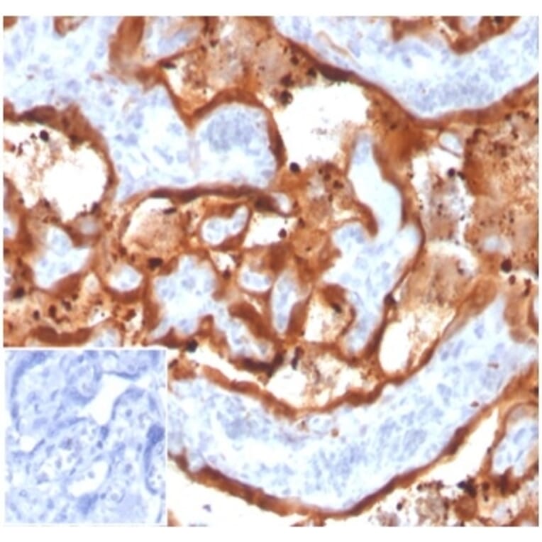 Immunohistochemistry - Anti-Transglutaminase II Antibody [TGM2/3612] - BSA and Azide free (A278408) - Antibodies.com