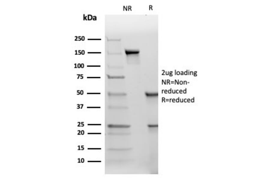 SDS-PAGE - Anti-TIMP2 Antibody [TIMP2/4477] - BSA and Azide free (A278409) - Antibodies.com