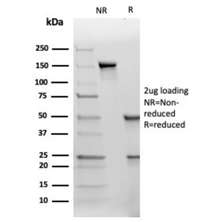 SDS-PAGE - Anti-TIMP2 Antibody [TIMP2/4477] - BSA and Azide free (A278409) - Antibodies.com