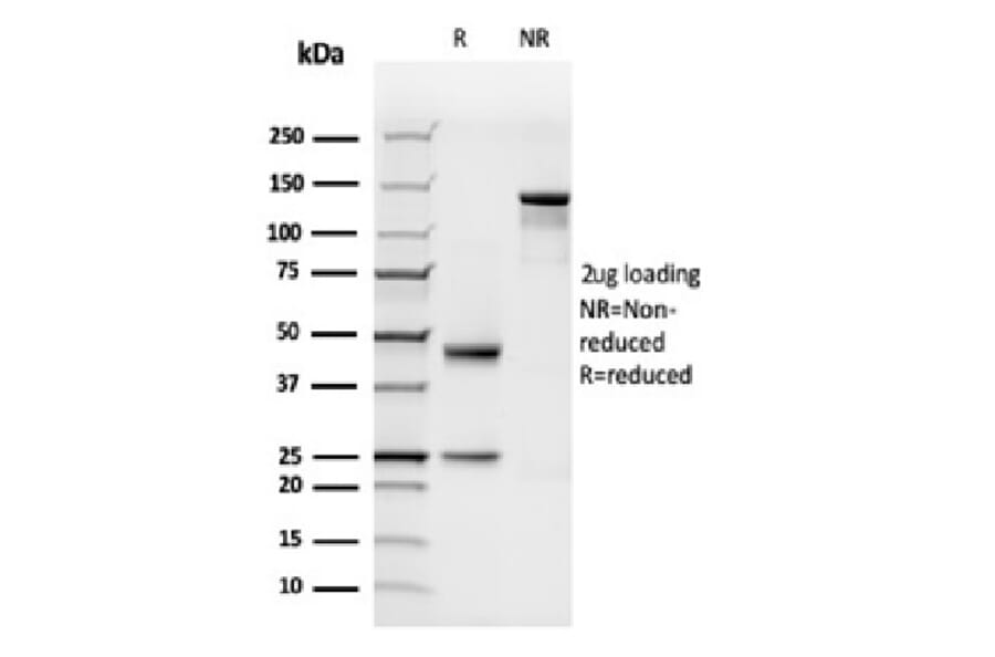 SDS-PAGE - Anti-C1QB Antibody [C1QB/2962] - BSA and Azide free (A278410) - Antibodies.com