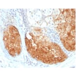 Immunohistochemistry - Anti-Tyrosinase Antibody [TYR/3826] - BSA and Azide free (A278411) - Antibodies.com