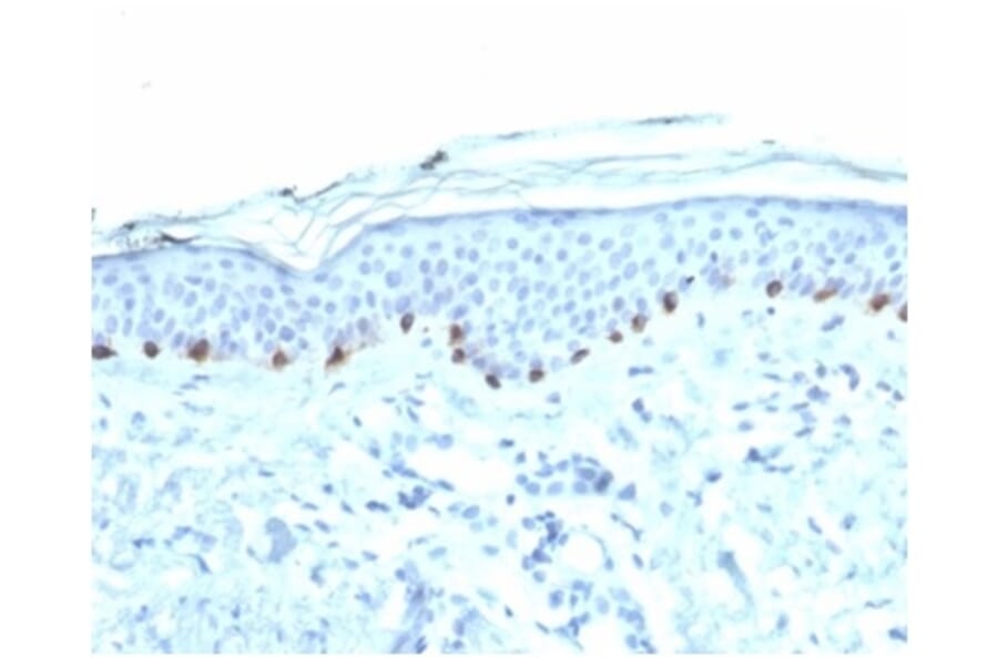 Immunohistochemistry - Anti-Tyrosinase Antibody [TYR/3826] - BSA and Azide free (A278411) - Antibodies.com