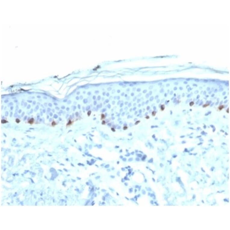 Immunohistochemistry - Anti-Tyrosinase Antibody [TYR/3826] - BSA and Azide free (A278411) - Antibodies.com