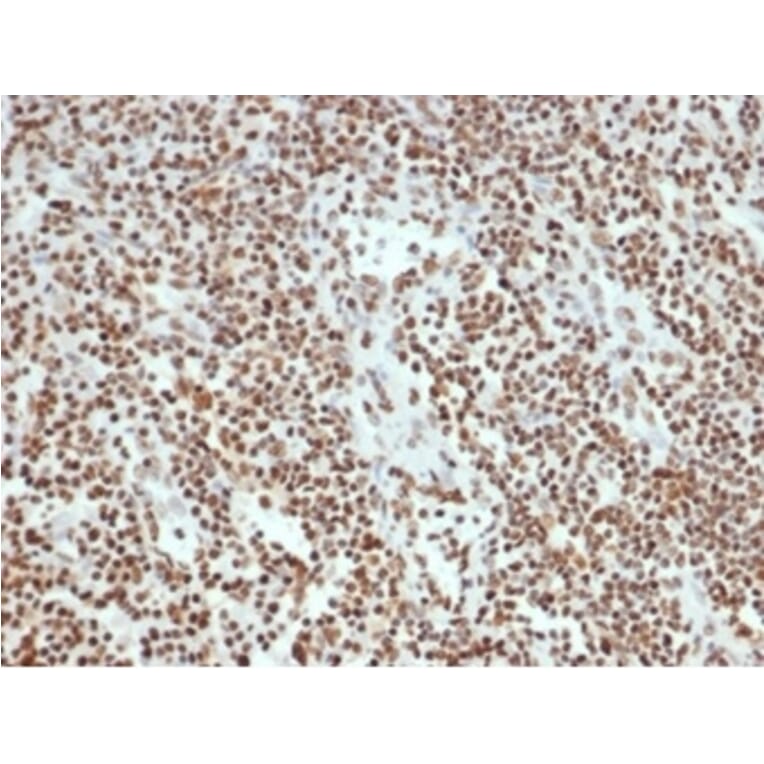 Immunohistochemistry - Anti-Ku80 Antibody [XRCC5/7315] - BSA and Azide free (A278412) - Antibodies.com