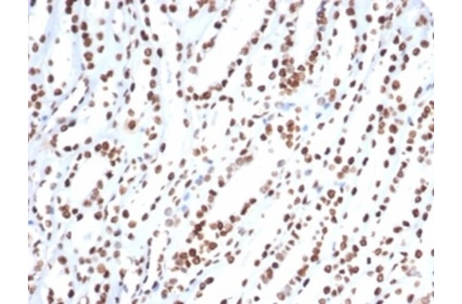 Immunohistochemistry - Anti-Ku80 Antibody [XRCC5/7318] - BSA and Azide free (A278414) - Antibodies.com