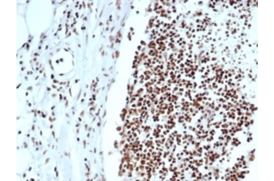 Immunohistochemistry - Anti-Ku80 Antibody [XRCC5/7318] - BSA and Azide free (A278414) - Antibodies.com