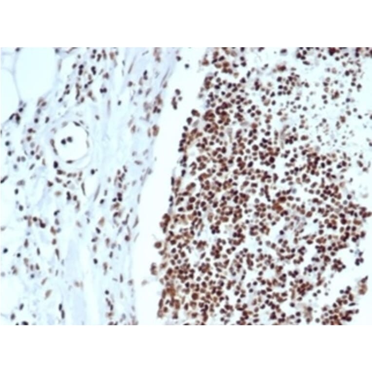 Immunohistochemistry - Anti-Ku80 Antibody [XRCC5/7318] - BSA and Azide free (A278414) - Antibodies.com