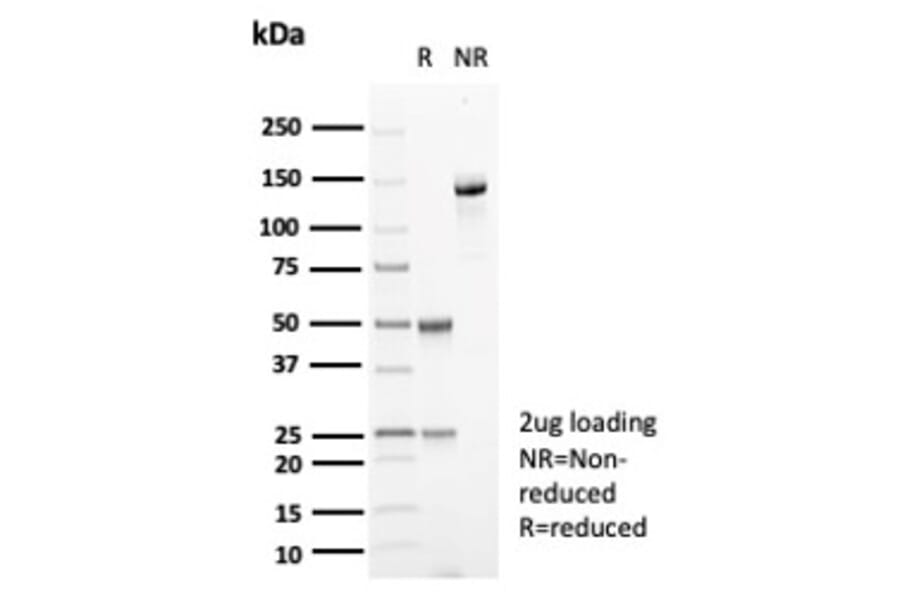 SDS-PAGE - Anti-Carbonic Anhydrase VIII Antibody [CA8/6572] - BSA and Azide free (A278415) - Antibodies.com