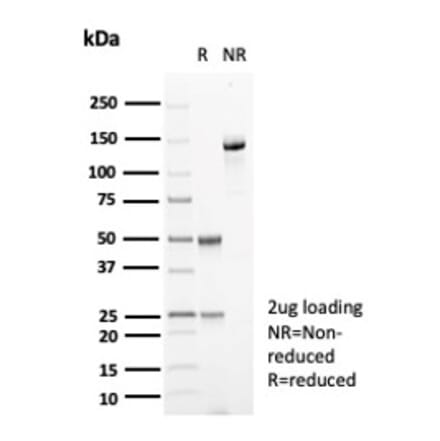 SDS-PAGE - Anti-Carbonic Anhydrase VIII Antibody [CA8/6572] - BSA and Azide free (A278415) - Antibodies.com