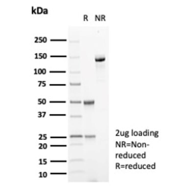 SDS-PAGE - Anti-Carbonic Anhydrase VIII Antibody [CA8/6572] - BSA and Azide free (A278415) - Antibodies.com