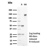 SDS-PAGE - Anti-Carbonic Anhydrase VIII Antibody [CA8/6572] - BSA and Azide free (A278415) - Antibodies.com