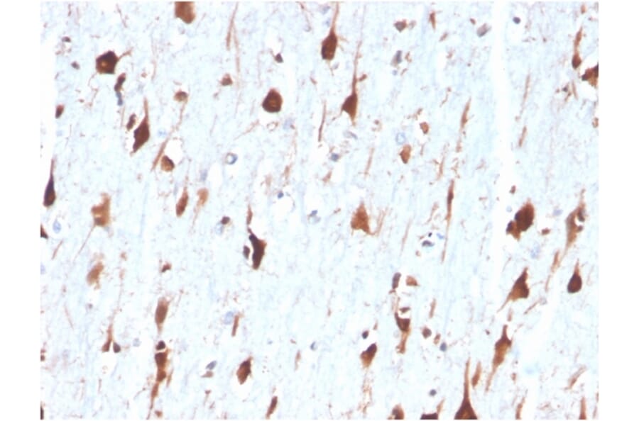 Immunohistochemistry - Anti-Carbonic Anhydrase VIII Antibody [CA8/6572] - BSA and Azide free (A278415) - Antibodies.com