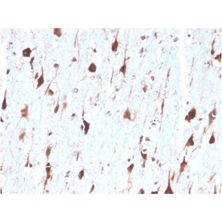 Immunohistochemistry - Anti-Carbonic Anhydrase VIII Antibody [CA8/6572] - BSA and Azide free (A278415) - Antibodies.com