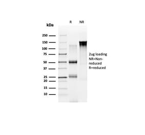 SDS-PAGE - Anti-NOC4L Antibody [PCRP-NOC4L-1B2] - BSA and Azide free (A278416) - Antibodies.com